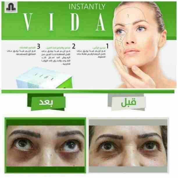 #من_مركز _بيلا _بيوتي💖
INSTANTLY VIDA
انستانتلي فيدا 😍
يعني هوة منتج تجميلي👩🏻 وعلاجي 💉
يعتبر تجميلي لان يكون بديل لبرايمر بسس😌بمواد طبيعية 100‎%‎
و علاجي لان يحوي على نسبة معالج تحسن من...